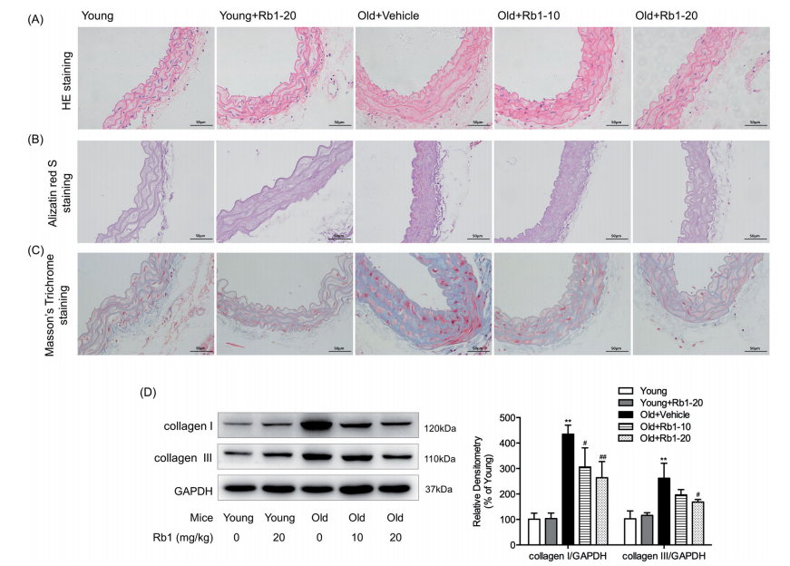 cistanche age-related vascular impairment